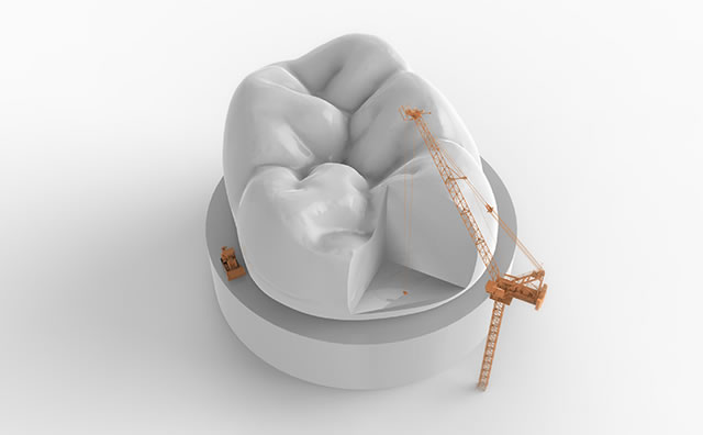 補(bǔ)牙百科介紹