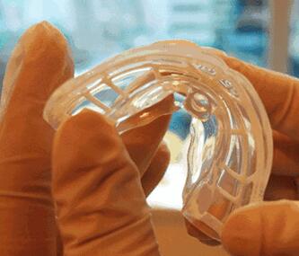 兒童牙齒矯正貴不貴？南通摩爾口腔六月MRC牙齒矯治5680元