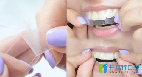 美白牙貼能對牙齒快速美白