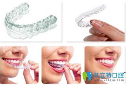 隱形正畸治療