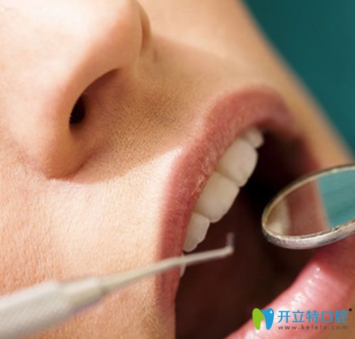 你說洗牙會(huì)讓牙齒變松 立勤口腔整理洗牙前需要了解5個(gè)問題