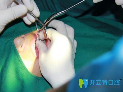 合肥佳德口腔牙齒種植案例