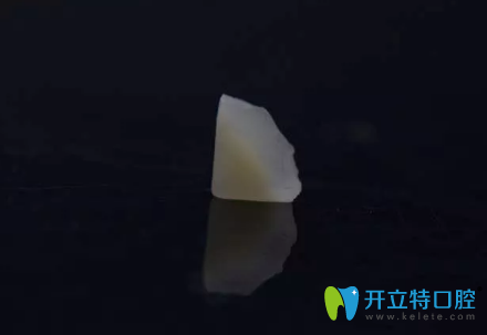 制作完成的嵌體修復