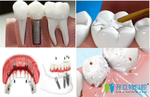 洛陽(yáng)維樂(lè)口腔門診部宣傳圖