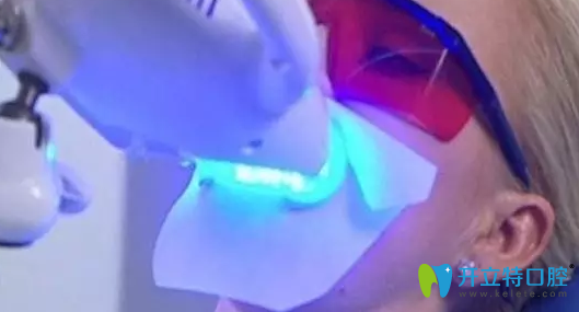 牙齒發(fā)黃不好看？咸陽三秦口腔冷光美白還你亮齒白