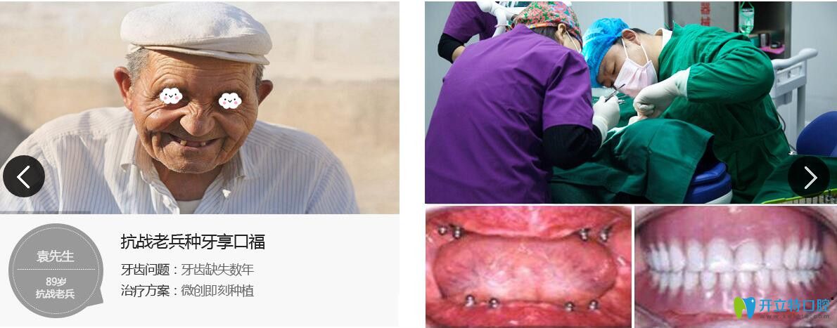 濟民口腔為牙齒缺失數(shù)年抗戰(zhàn)老兵做微創(chuàng)即刻種植