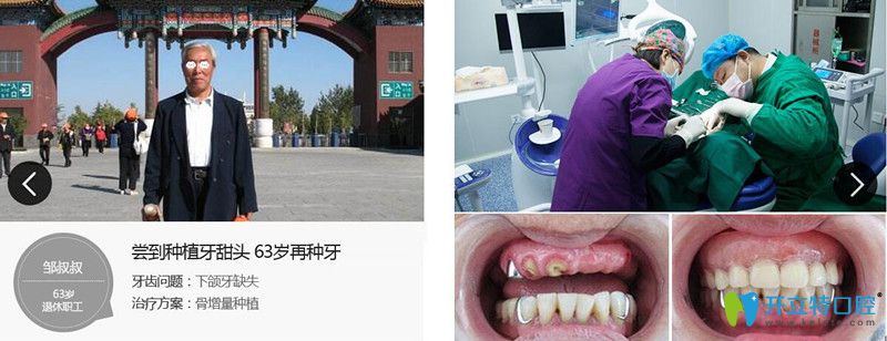 王繼民為下頜牙缺失者進行牙齒種植