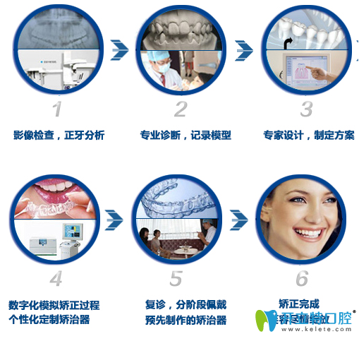 德陽(yáng)新橋口腔3D數(shù)碼隱形正畸過(guò)程