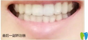 牙齒還白了許多呢