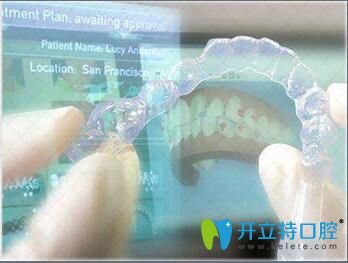 烏魯木齊美奧口腔門(mén)診數(shù)字化矯正系統(tǒng)優(yōu)勢(shì)