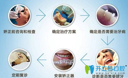 牙齒矯正注意事項