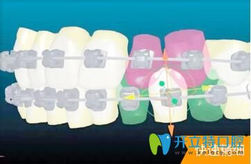 烏魯木齊美奧口腔門(mén)診數(shù)字化矯正系統(tǒng)更精準(zhǔn)