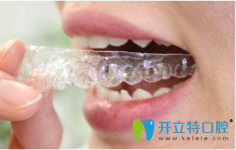 洛陽(yáng)維樂(lè)口腔牙齒矯正宣傳圖