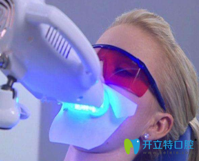 牙齒冷光美白