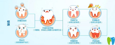 患有牙周病的人平時應(yīng)注意些什么？