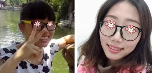 事實(shí)證明沈陽愛齒口腔張小龍給我做的齙牙矯正效果蠻好！