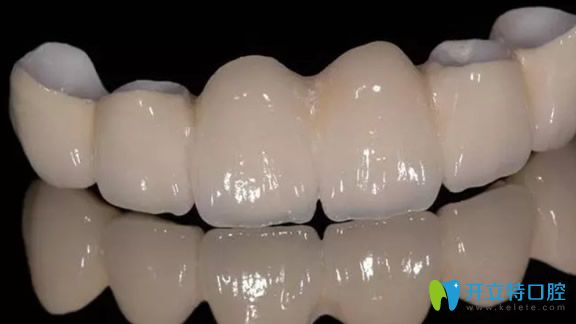 全瓷牙對牙釉質(zhì)磨損較小