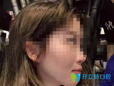 沒想到效果真的很好，我很感謝西安諾貝爾