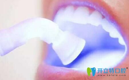 漯河蘇瑞品口腔牙齒冷光美白讓顧客牙齒立刻提升6個(gè)色階