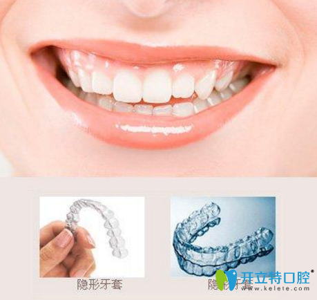 菏澤美爾口腔隱形矯正牙套