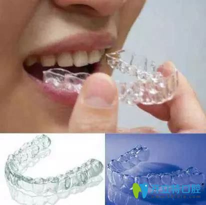 白山欣美口腔診所隱形牙齒矯正