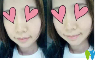 咬合完全正確后我簡(jiǎn)直就是小仙女哈哈