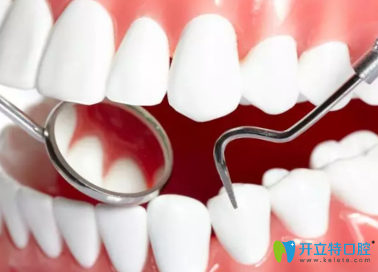 菏澤美爾口腔成年矯正牙齒