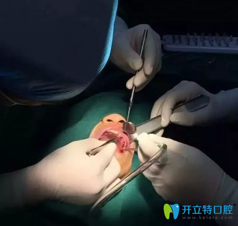 佛山拜博口腔1小時(shí)<span style= 佛山拜博口腔1小時(shí)<span style=