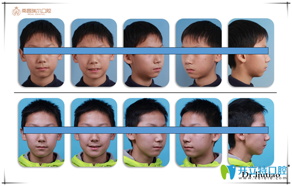 擁擠，單純排齊