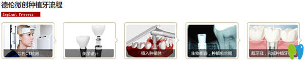 瑞爾口腔種植牙的簡單流程圖 瑞爾口腔種植牙的簡單流程圖