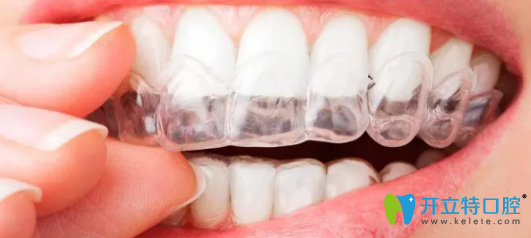 榆林長(zhǎng)虹口腔隱形牙齒矯正器