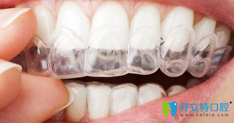 北京科瓦齒科貴嗎?老顧客親測:幾千塊種牙+德國技術(shù)真不坑