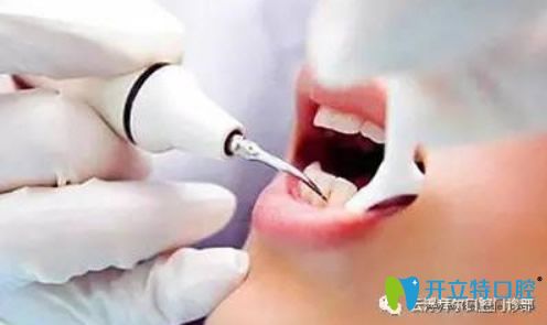 云浮拜爾口腔微創(chuàng)無痛拔牙技術(shù)