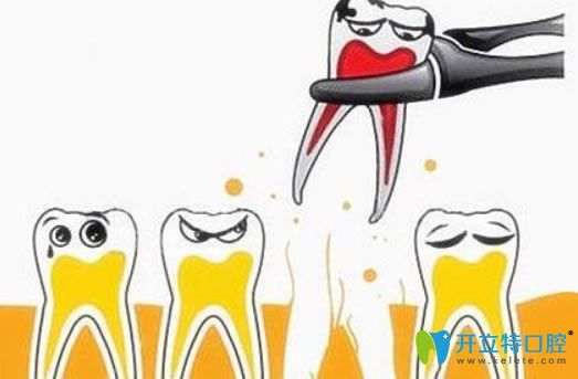 拔牙后的注意事項有哪些？威海舒好口腔劉炳黎院長來解答