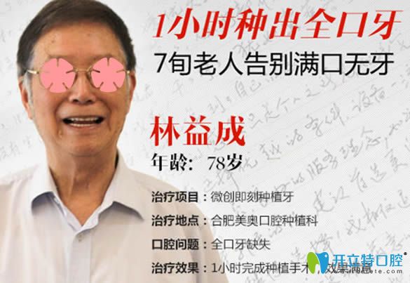 全口牙齒缺損的張大爺在合肥美奧收獲了滿口牙齒