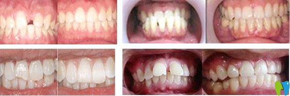 拜博口腔牙齒種植、牙齒矯正及牙齒美容修復(fù)<span style=