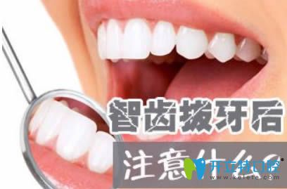 拔了智齒后要注意什么事項(xiàng)？深圳麥牙口腔的鄭蒼尚來解答