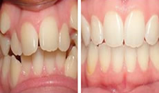 深圳諾德齒科價格怎么樣？看牙后顧客反饋性價比高