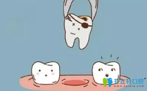 拔牙后多久可以鑲牙?聽深圳世紀河山口腔種植醫(yī)生解析