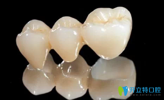 二氧化鋯全瓷牙價(jià)格是多少？深圳汪洋齒科吳健雄揭秘啦