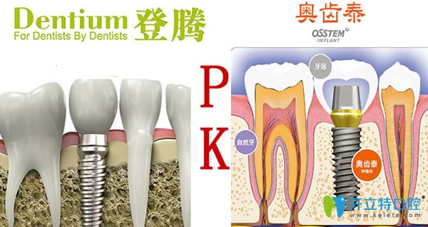 韓國(guó)登騰和奧齒泰哪個(gè)更好？?jī)蓚€(gè)種植體優(yōu)劣對(duì)比(2024新版)