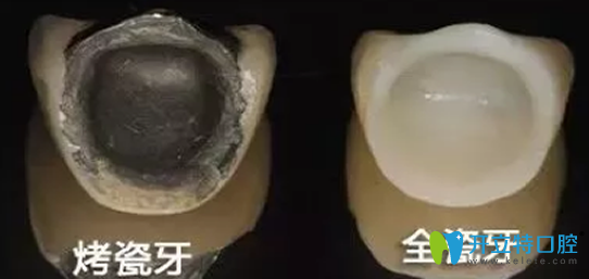 ?珠海九龍醫(yī)院種牙怎么樣?98%街坊說好,種牙960便宜但無套路
