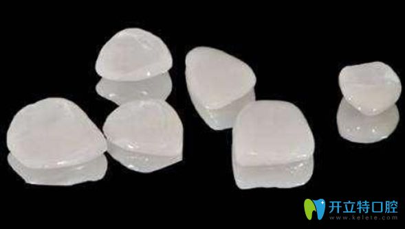 牙貼面是專門修復牙縫大的方法