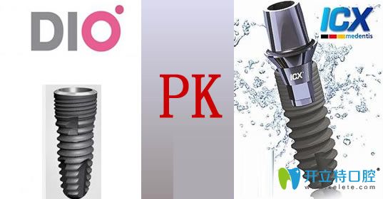 韓國(guó)dio和德國(guó)icx種植體綜合比較