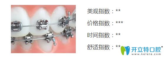 自鎖金屬托槽矯正