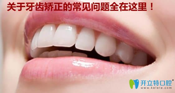 關(guān)于小孩牙齒矯正的年齡及其它常見(jiàn)問(wèn)題的解答都在這