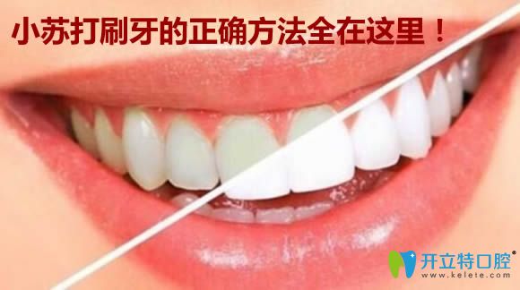 關(guān)于小蘇打刷牙的正確方法及刷牙多久能變白的答案都在這