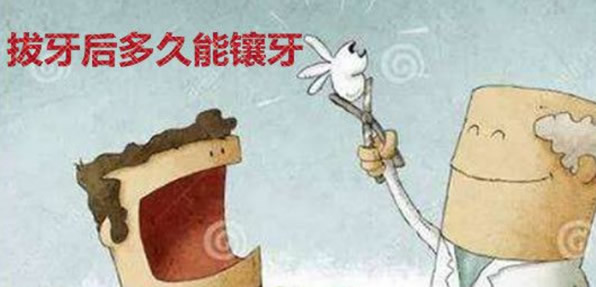 廣州番禺瑞德口腔解答拔牙后多久能鑲牙 為什么要在2-3月后