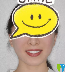 美樂(lè)口腔金屬托槽矯正牙齒18個(gè)月<span style=