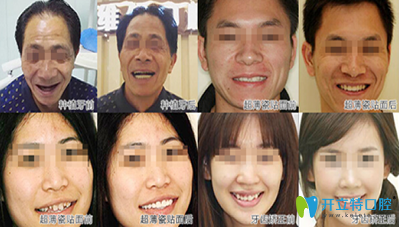 康貝佳口腔好不好？眾多真實案例來驗證